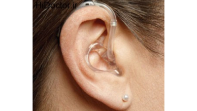 تنظیم و برنامه‌ریزی سمعک